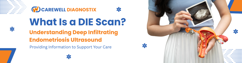 What Is a DIE Scan? Understanding Deep Infiltrating Endometriosis (DIE) Ultrasound.
